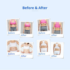 Shape Tactics 160mW Lipo Laser & Cavitation Cooling Contouring System - Machine Horizon