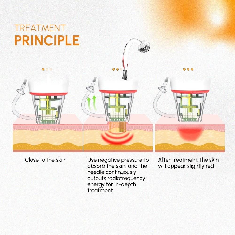 Shape Tactics 3-in-1 Targeted RF Microneedling System - Machine Horizon