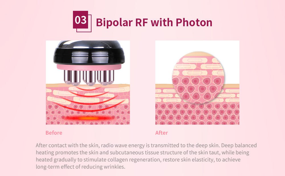 Shape Tactics 5-in-1 Cryolipolysis Vacuum RF Cooling System Shape Tactics 5-in-1 Cryolipolysis Vacuum RF Cooling System