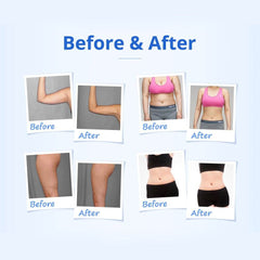 Shape Tactics 5-in-1 RF & 40K Cavitation Contouring System - Machine Horizon