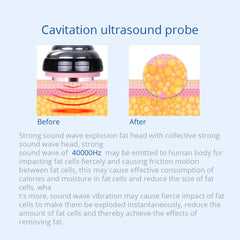 Shape Tactics 5-in-1 RF Cavitation Double-Handle Cryolipolysis Cooling System