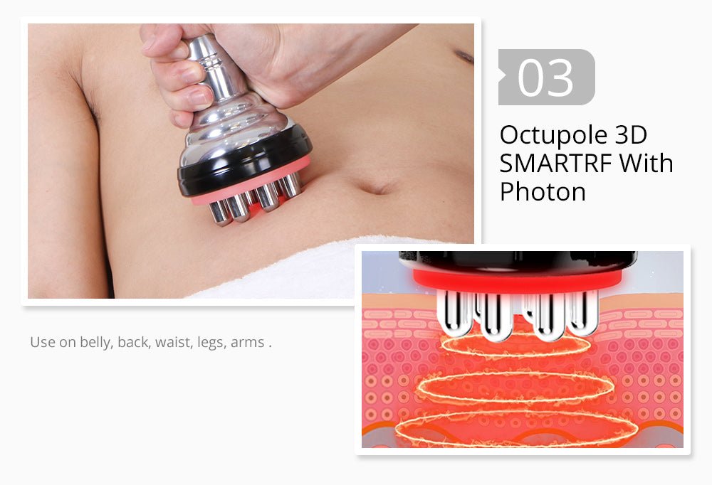 Shape Tactics 5-in-1 Unoisetion Cavitation 2.0 3D Smart Vacuum RF System Shape Tactics 5-in-1 Unoisetion Cavitation 2.0 3D Smart Vacuum RF System