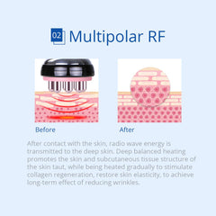 Shape Tactics 6-in-1 Cavitation RF Cryolipolysis Lipo Laser System