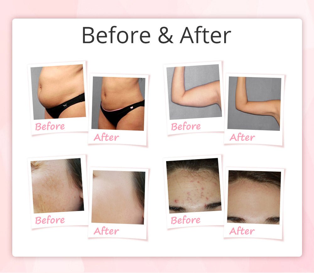 Shape Tactics 9-in-1 Unoisetion Cavitation RF Vacuum Bio Photon System Shape Tactics 9-in-1 Unoisetion Cavitation RF Vacuum Bio Photon System