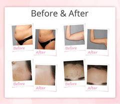 Shape Tactics 9-in-1 Unoisetion Cavitation RF Vacuum Bio Photon System