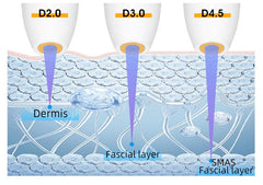 Shape Tactics Advanced 7D HIFU Skin Care System