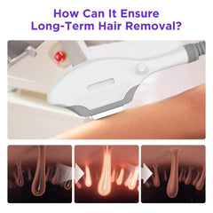 Shape Tactics IPL Hair Removal and Skin Rejuvenation System - Machine Horizon