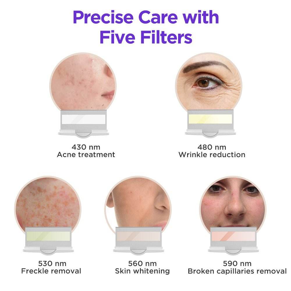 Shape Tactics IPL Hair Removal and Skin Rejuvenation System - Machine Horizon