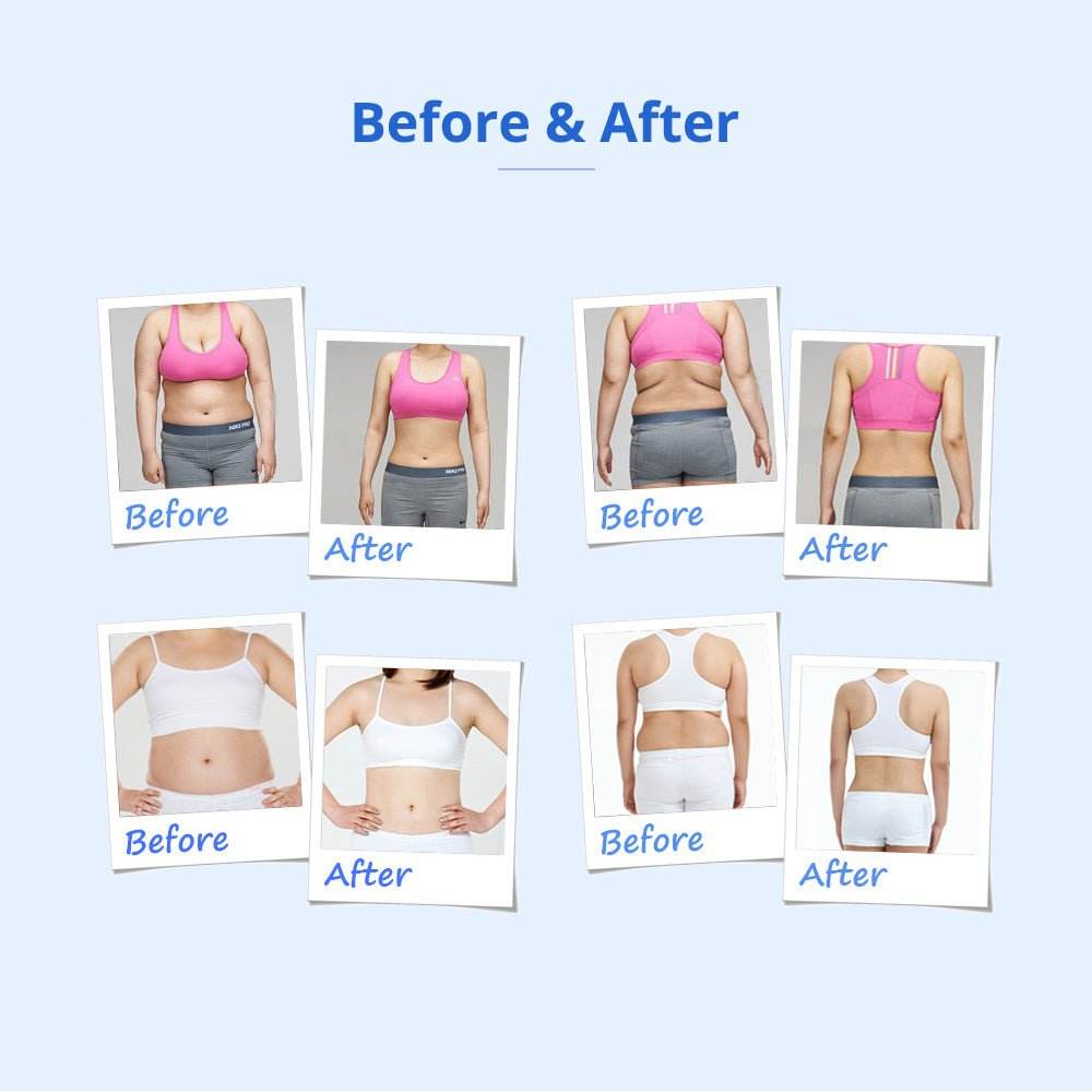 Shape Tactics 160mW Lipo Laser & Cavitation Cooling Contouring System - Machine Horizon