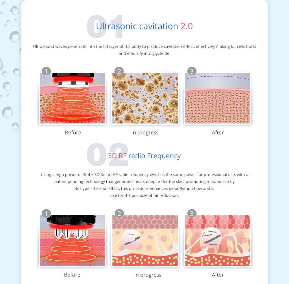 Shape Tactics 5-in-1 Cavitation Cryolipolysis Lipo Laser System - Machine Horizon
