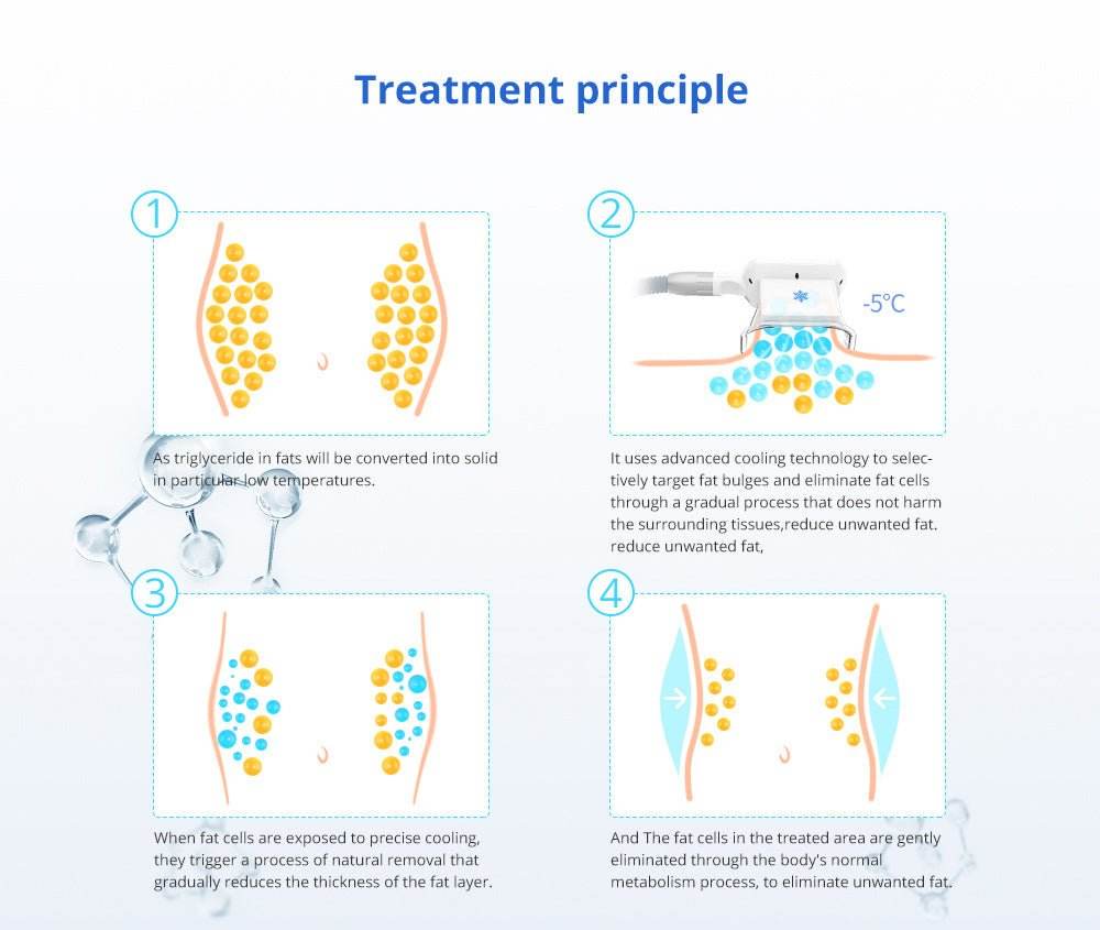 Shape Tactics 5-in-1 Cavitation Cryolipolysis Lipo Laser System - Machine Horizon