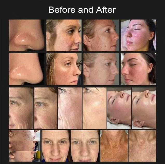 Shape Tactics 8-in-1 Hot & Cold Fusion Plasma Facial Beauty System - Machine Horizon