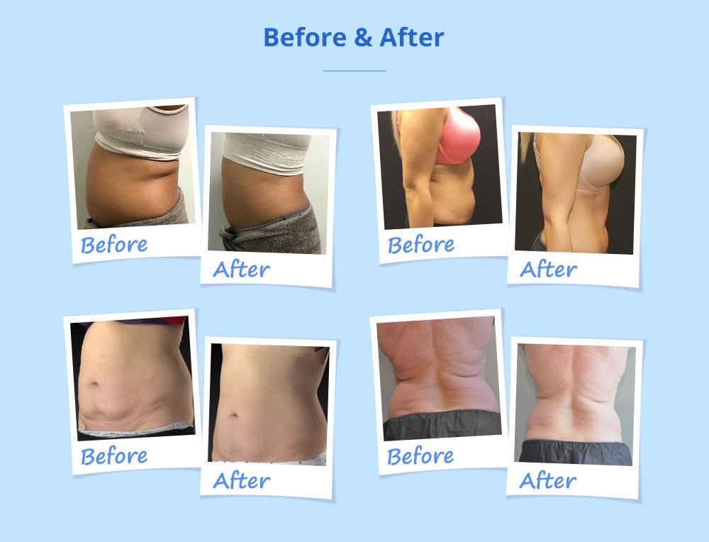 Shape Tactics Advanced Stand-Up Cooling Contouring System