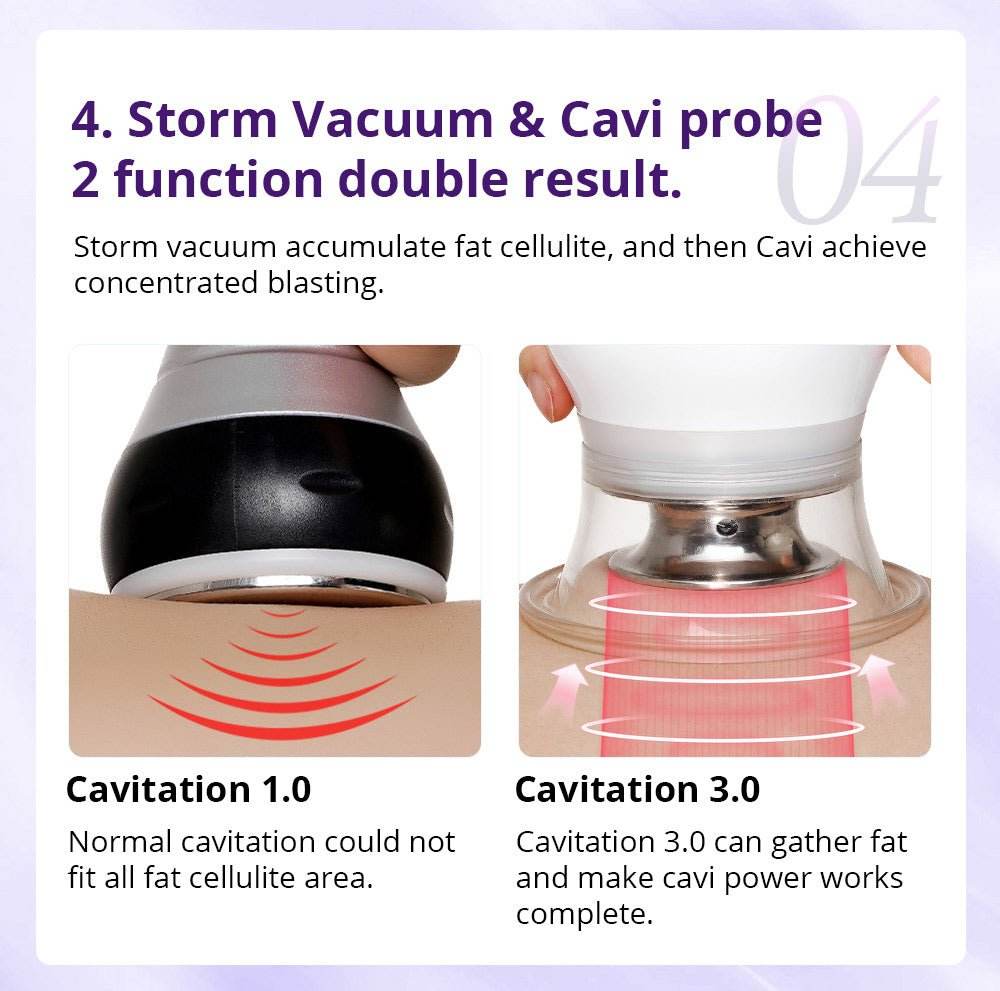 Shape Tactics Cavstorm 40K Cavitation 3.0 with Microcurrent RF System - Machine Horizon