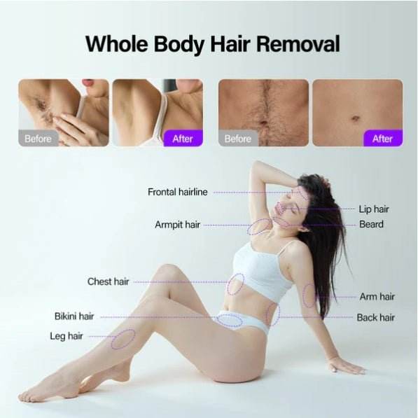 Shape Tactics Soprano Ice Pro 4-in-1 Laser Hair & Skin System - Machine Horizon